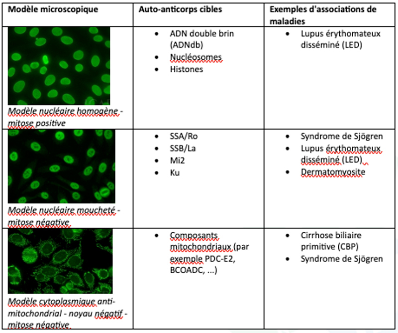 l-interpr-tation-des-anticorps-antinucl-aires-ana-plus-compl-te