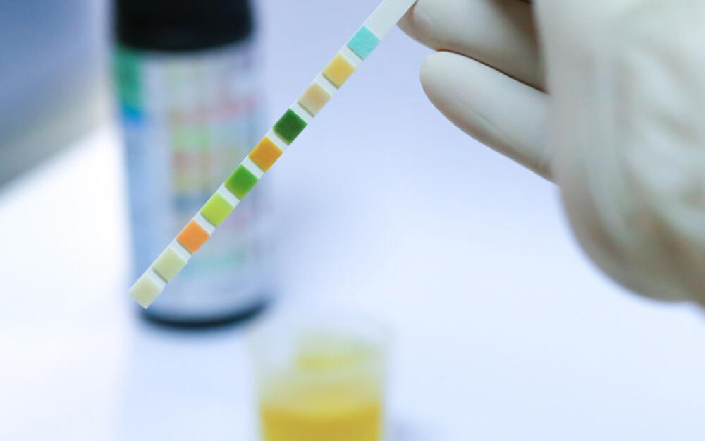 Urineweginfecties 800 500