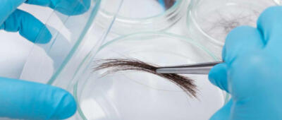 Haaranalyse 800 500