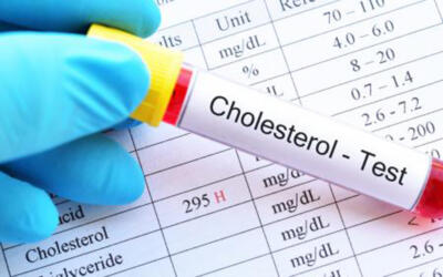 Cholesterol1 800 500