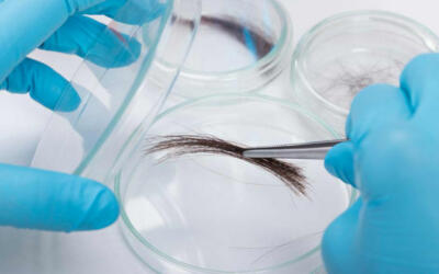 Haaranalyse 800 500