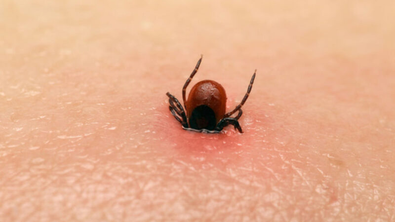 Ziekte van lyme1