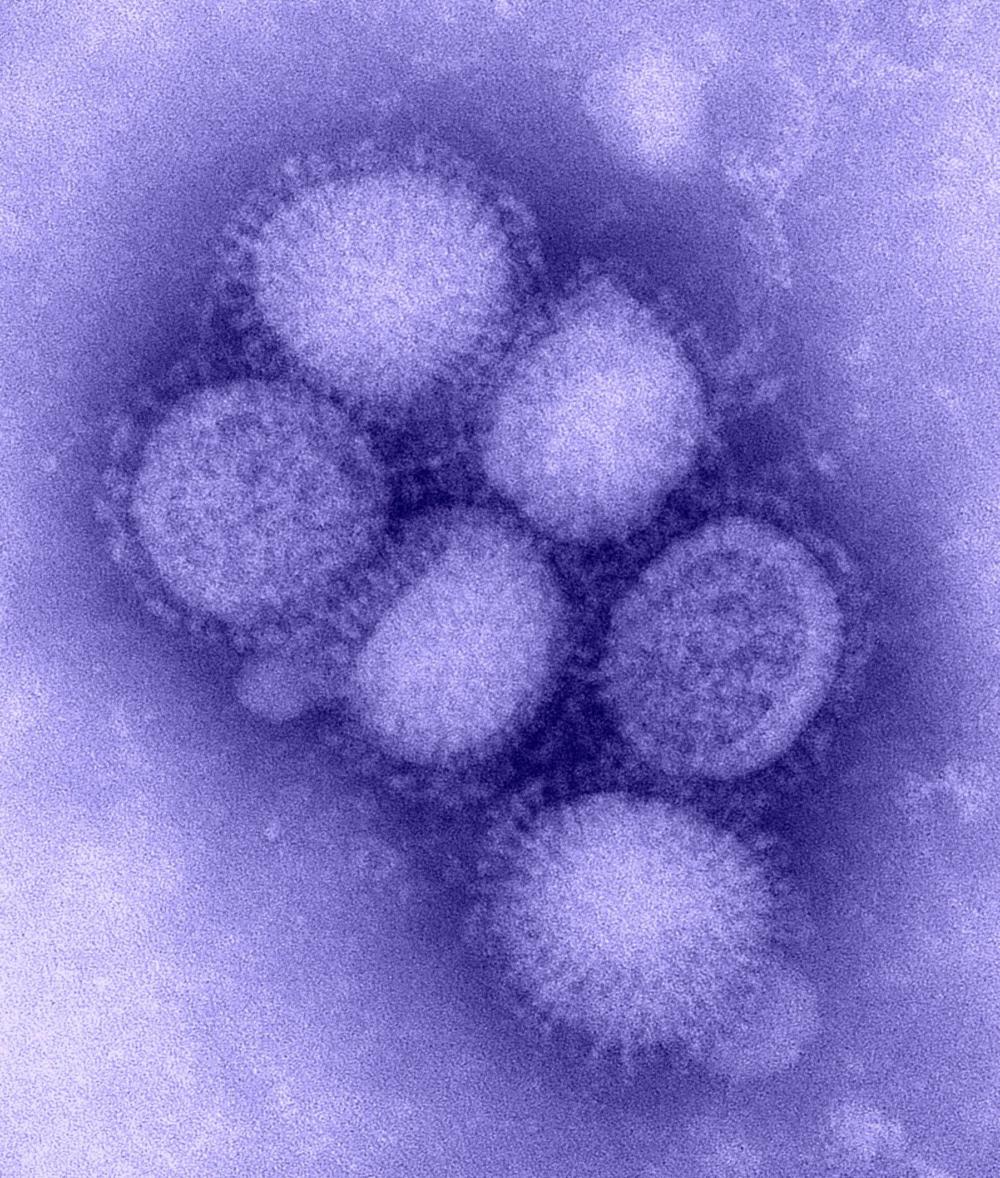 H1 N1 influenza virus