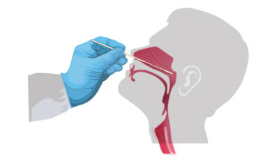 Nasal swab